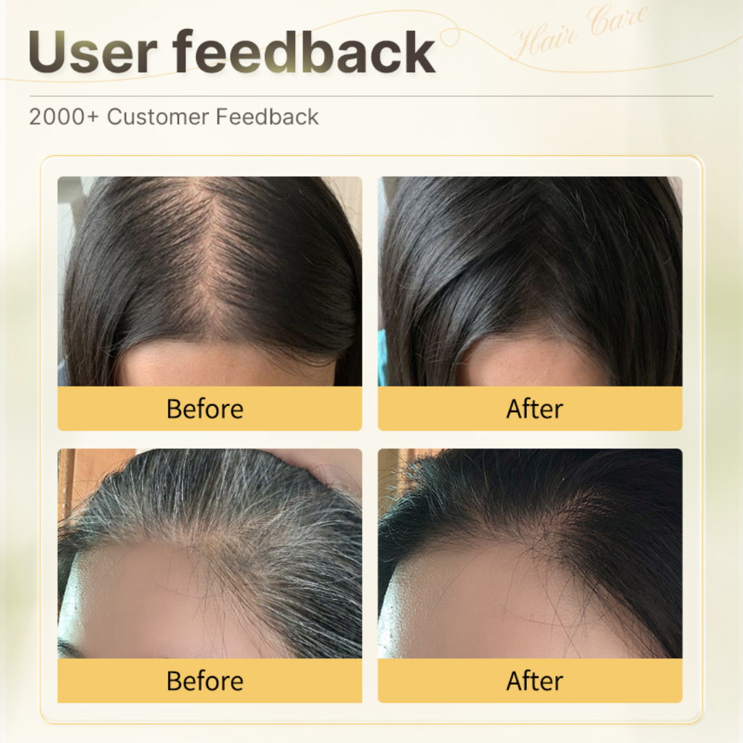 Proskire Anti-Grey Hair Serum | Reduces White Hair | Controls Hair Fall