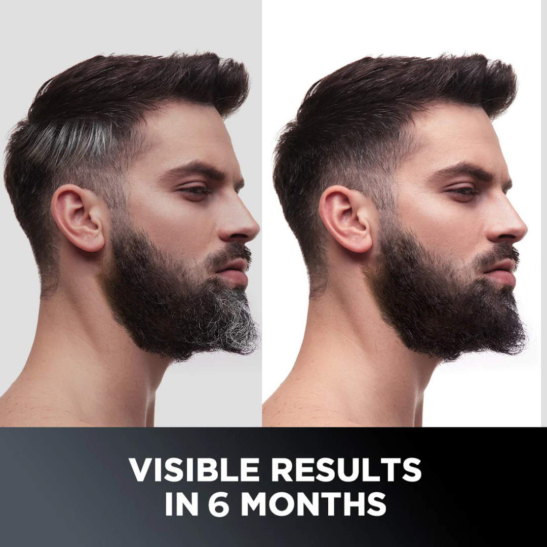 Proskire Anti-Grey Hair Serum | Reduces White Hair | Controls Hair Fall