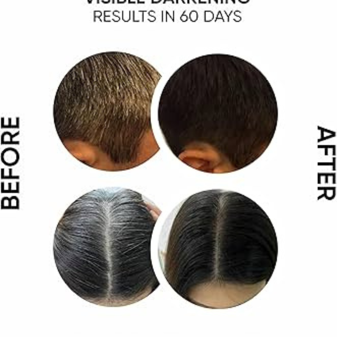 Proskire Anti-Grey Hair Serum | Reduces White Hair | Controls Hair Fall