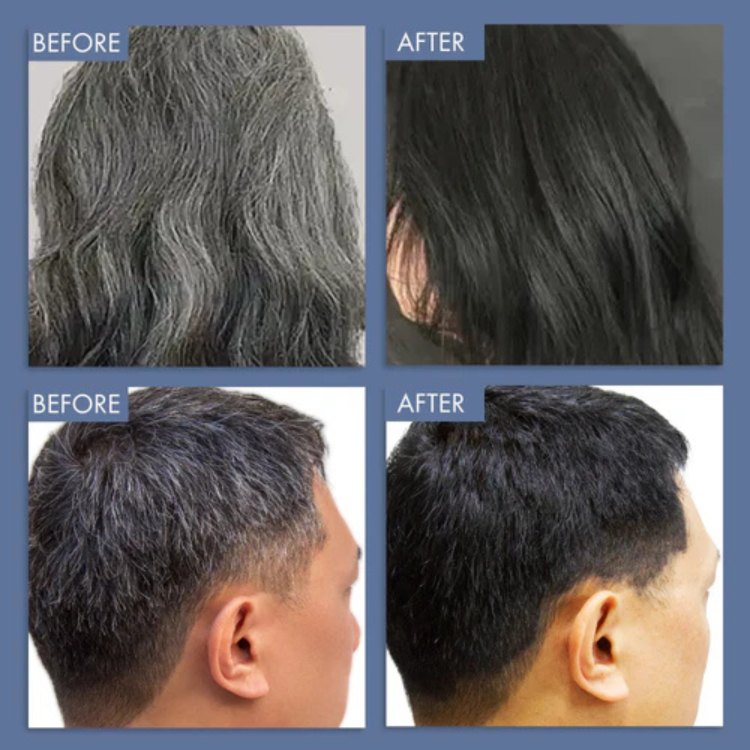 Proskire Anti-Grey Hair Serum | Reduces White Hair | Controls Hair Fall