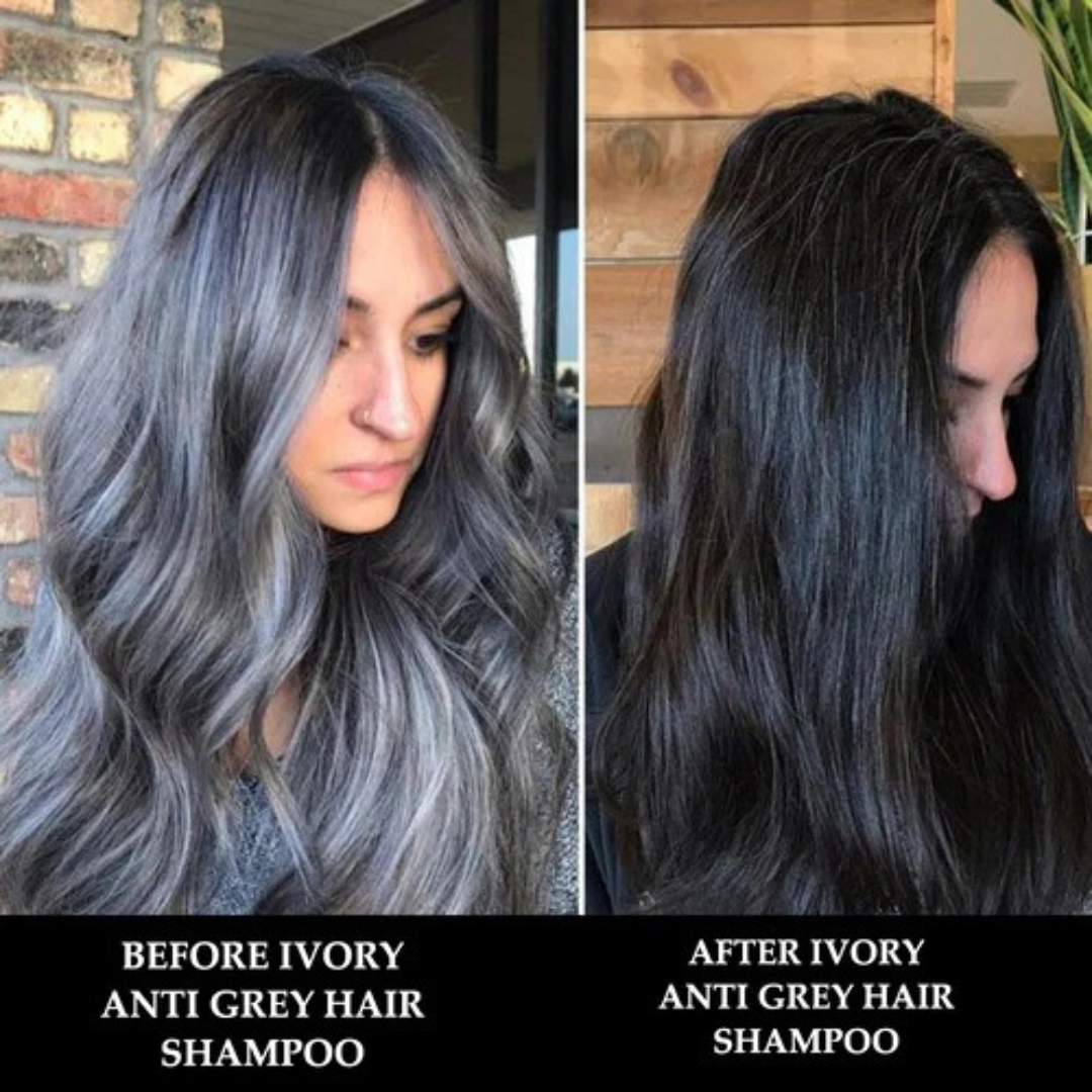 Proskire Anti-Grey Hair Serum | Reduces White Hair | Controls Hair Fall