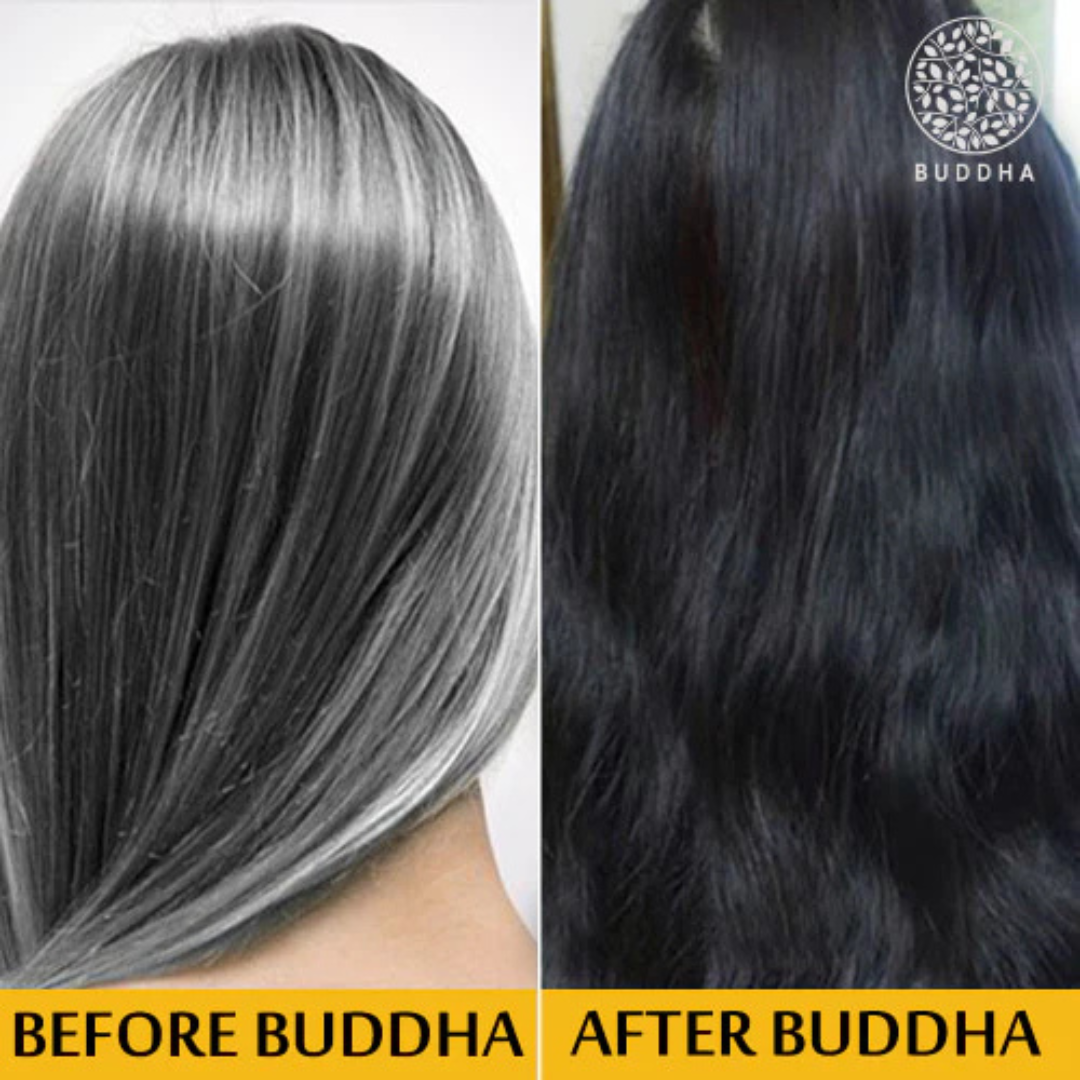Proskire Anti-Grey Hair Serum | Reduces White Hair | Controls Hair Fall