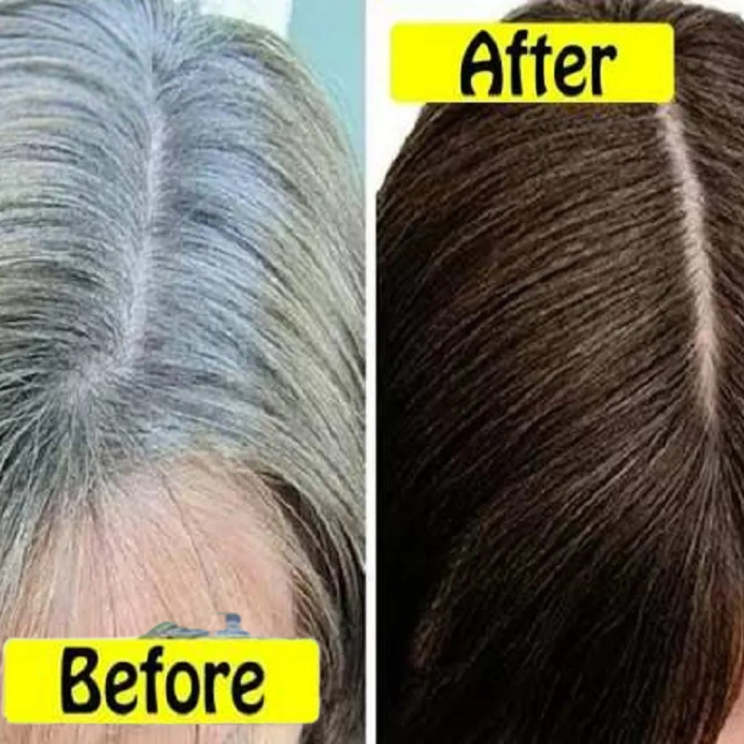 Proskire Anti-Grey Hair Serum | Reduces White Hair | Controls Hair Fall