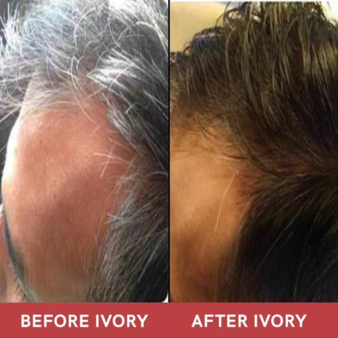 Proskire Anti-Grey Hair Serum | Reduces White Hair | Controls Hair Fall