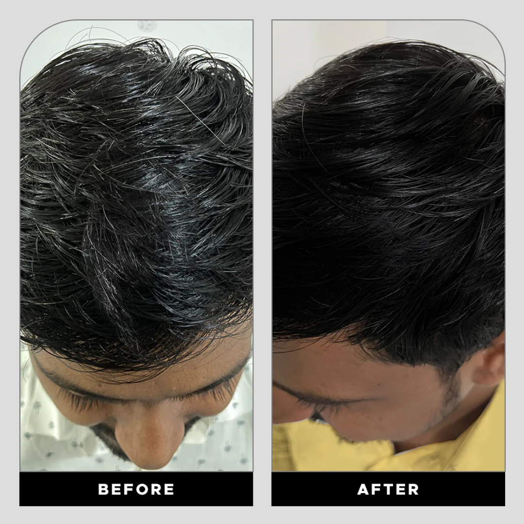 Proskire Anti-Grey Hair Serum | Reduces White Hair | Controls Hair Fall