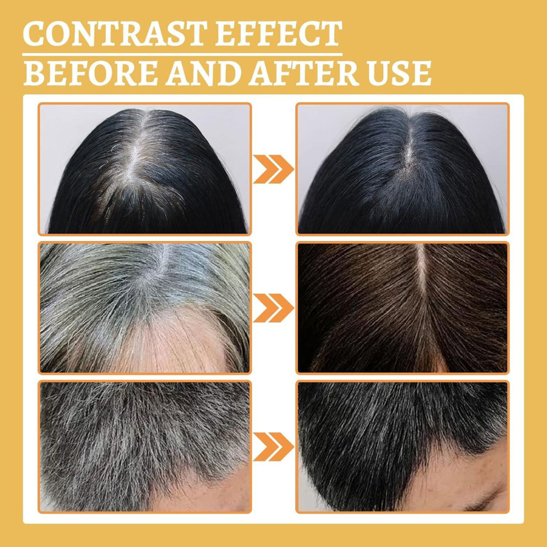 Proskire Anti-Grey Hair Serum | Reduces White Hair | Controls Hair Fall